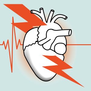 Myocardial Infarction