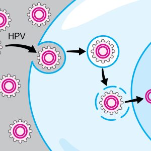 HPV-Associated Oral and Throat Cancer: What You Need to Know